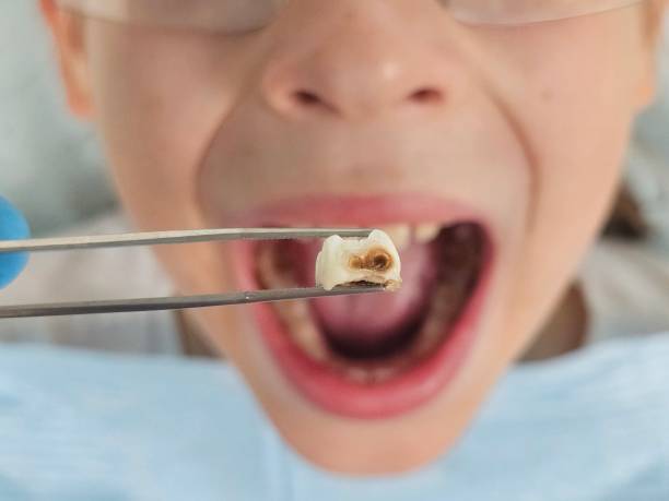 Best Pediatric Emergency Dentist in Ebensburg, PA
